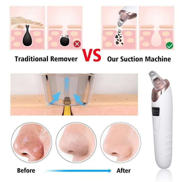Face Vacuum Blackhead Remover Pore Cleaner | Electric Deep Cleansing Tool for Nose & Face