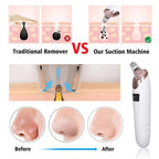Face Vacuum Blackhead Remover Pore Cleaner | Electric Deep Cleansing Tool for Nose & Face